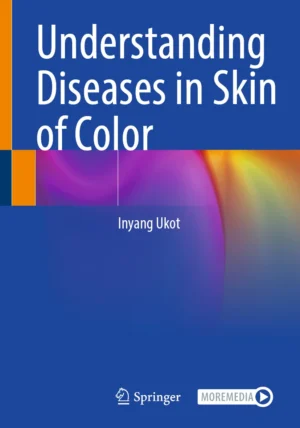 understanding diseases in skin of color